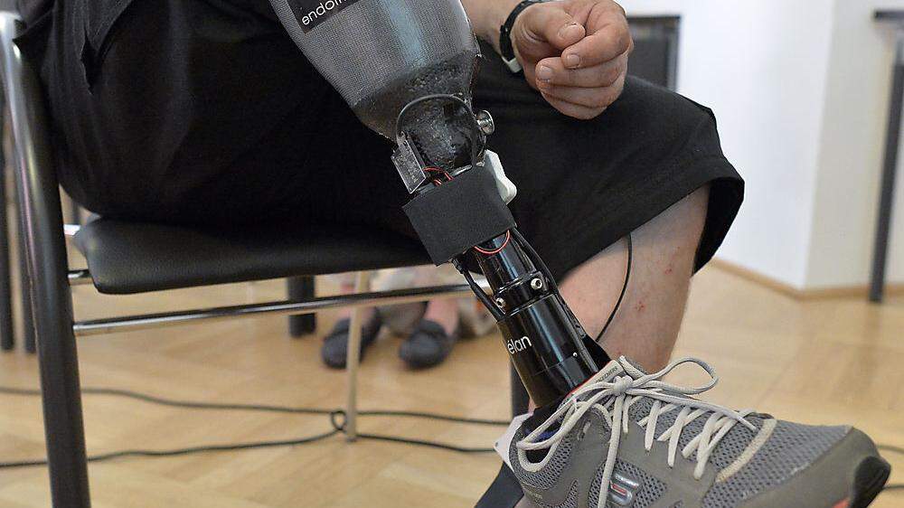 Präsentation der fühlenden Beinprothese in Wien