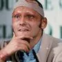 Niki Lauda nach seinem schweren Unfall am Nürburgring