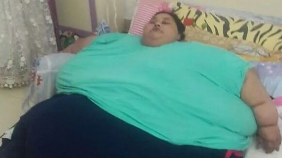 Die rund 500 Kilogramm schwere Ägypterin Eman Ahmed Abd al-Ati