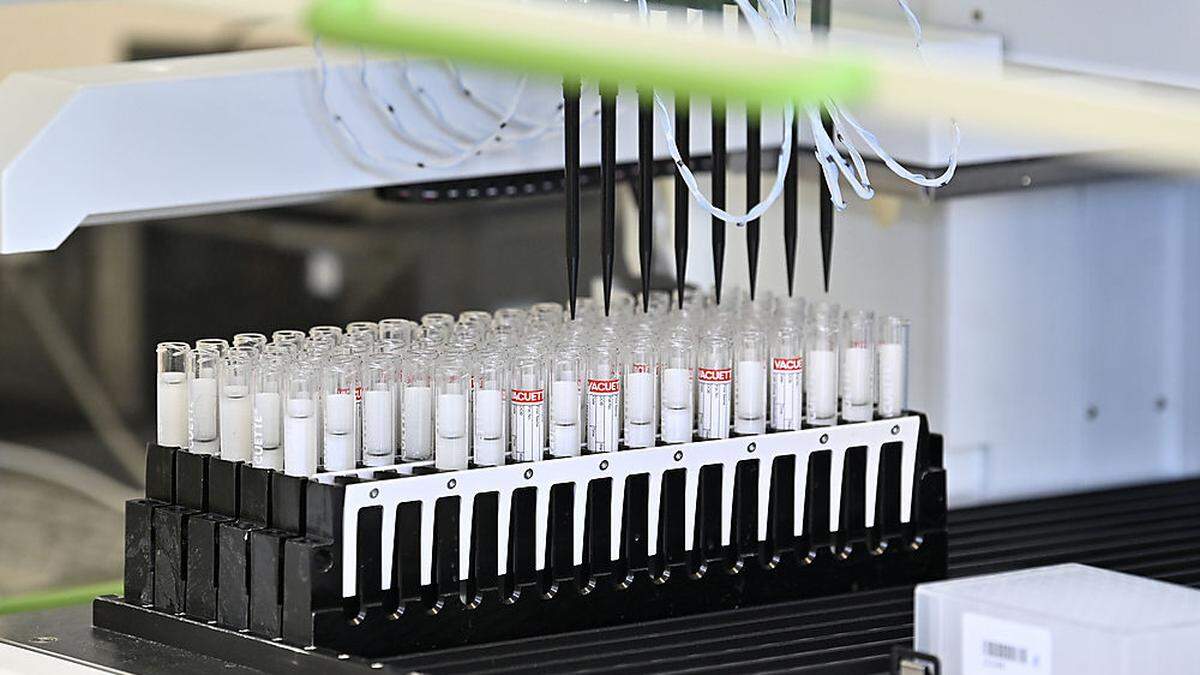 In den Labors werden auf Hochtouren Coronatests ausgewertet (Sujetbild)