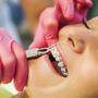 Seit Juli 2015 wurden in Österreich rund 86.000 Gratis-Zahnspangen verordnet
