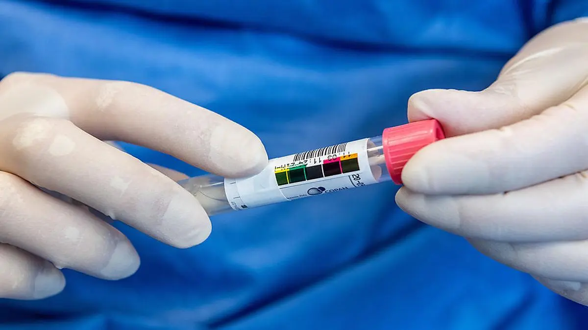 Ein Bild aus der Virologie am Uniklinikum Dresden in Deutschland