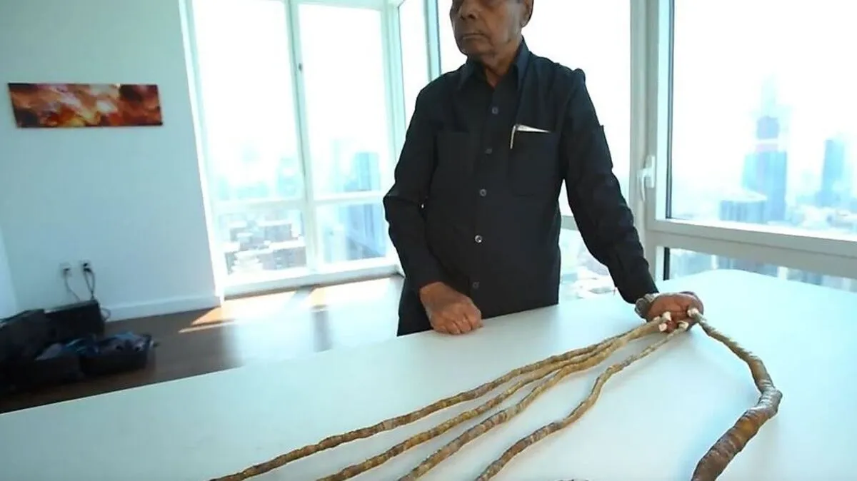 Der Inder hatte die Nägel seiner linken Hand seit 1952 nicht mehr abgeschnitten