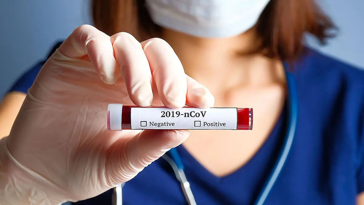 101 Neuinfektionen meldet das Land Kärnten am Sonntag