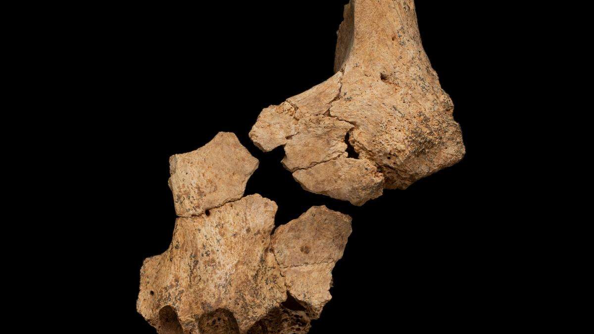 Der Gesichtsknochen ist rund 1,4 Millionen Jahre alt und eine paläontologische Sensation