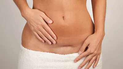 Ein Einschnitt, der bleibt