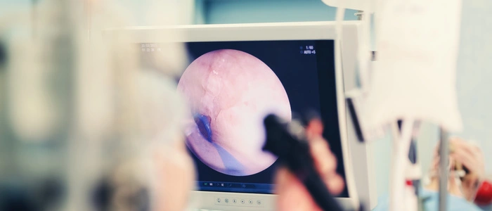 Magenballone kamen schon bislang in der Adipositastherapie zum Einsatz. Allerdings wurden sie im Rahmen einer Gastroskopie in den Magen eingebracht.