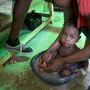 Ein kleiner Bub wird im CTC (Cholera Treatment Center) behandelt