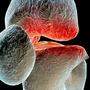 Arthrose: Der Knorpel verschleißt, die Knochen reiben 