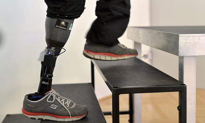 Mit der Beinprothese kann man laut Hersteller Stiegensteigen wie mit "normalen" Beinen
