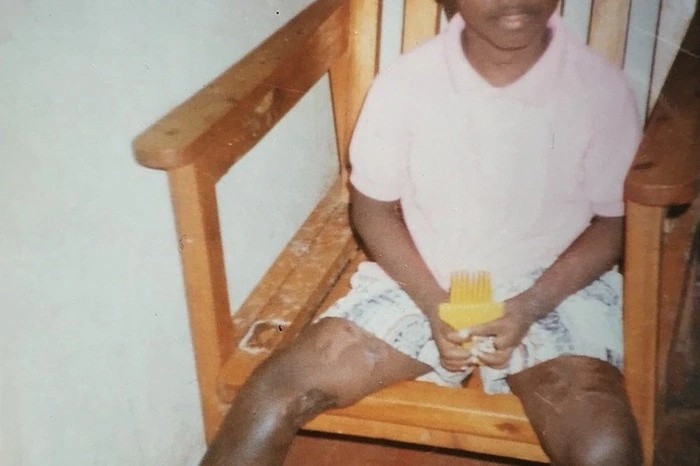 Erste Aktivität war die Spende für eine Fußprothese für Fabrice, einem Waisenkind aus Ruanda.