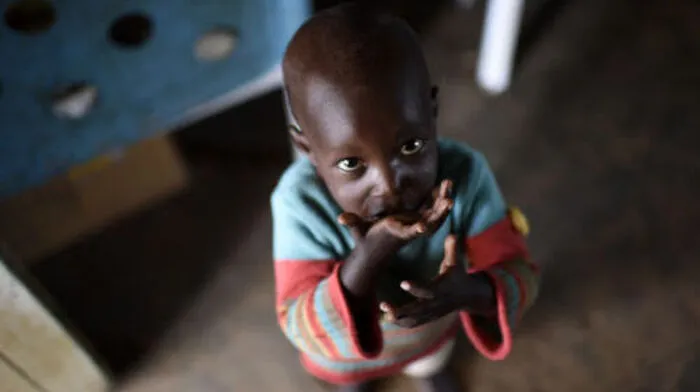 Besonders viele Hungernde gibt es im Südsudan