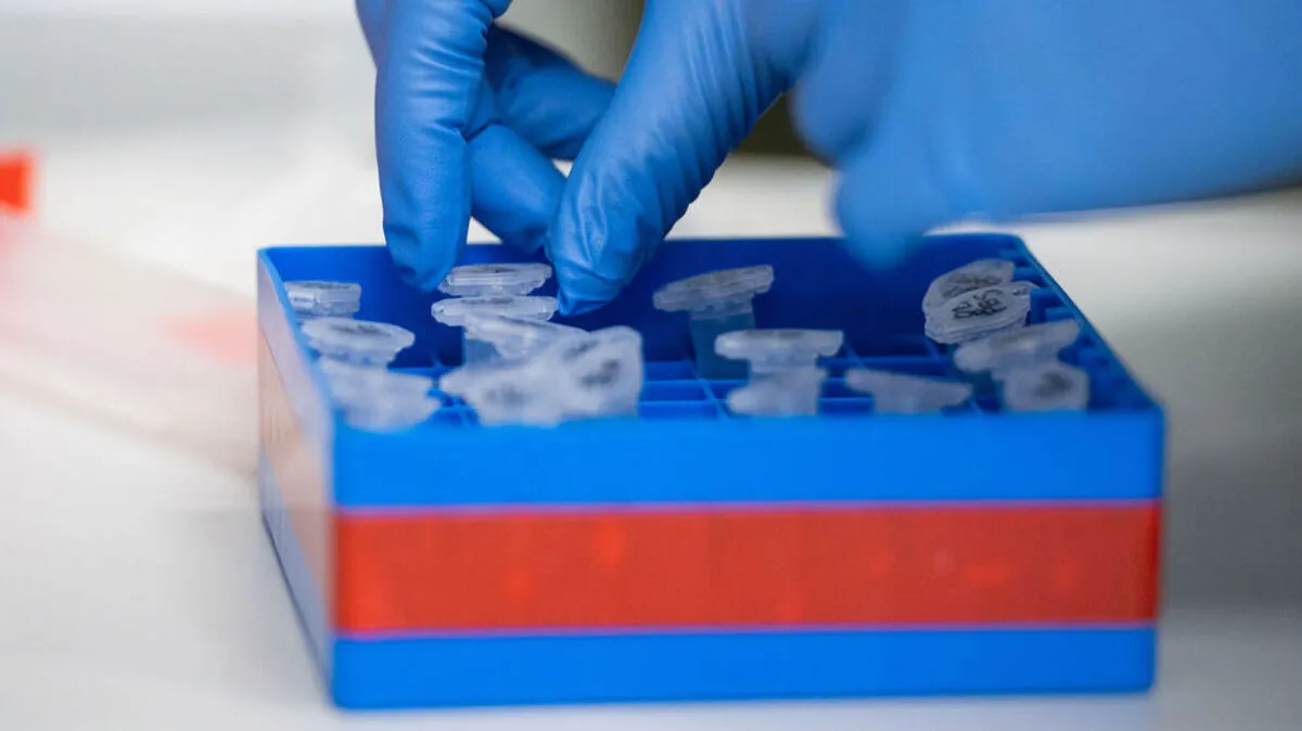 Untersuchungen zum Coronavirus