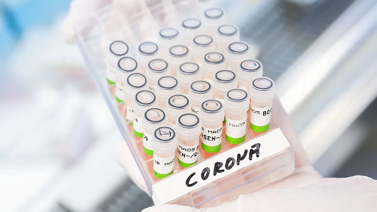 In den bereinigten Daten der AGES wurden für den gestrigen Dienstag 27.641 Neuinfektionen gemeldet