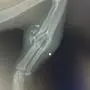 Röntgenbild, wo ein Flobert-Projektil einer Katze den Unterarm zertrümmerte 