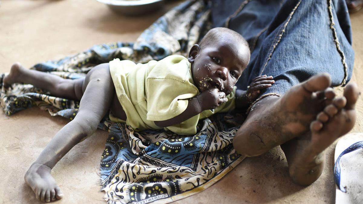 Die Kinder im Südsudan trifft die Not besonders hart