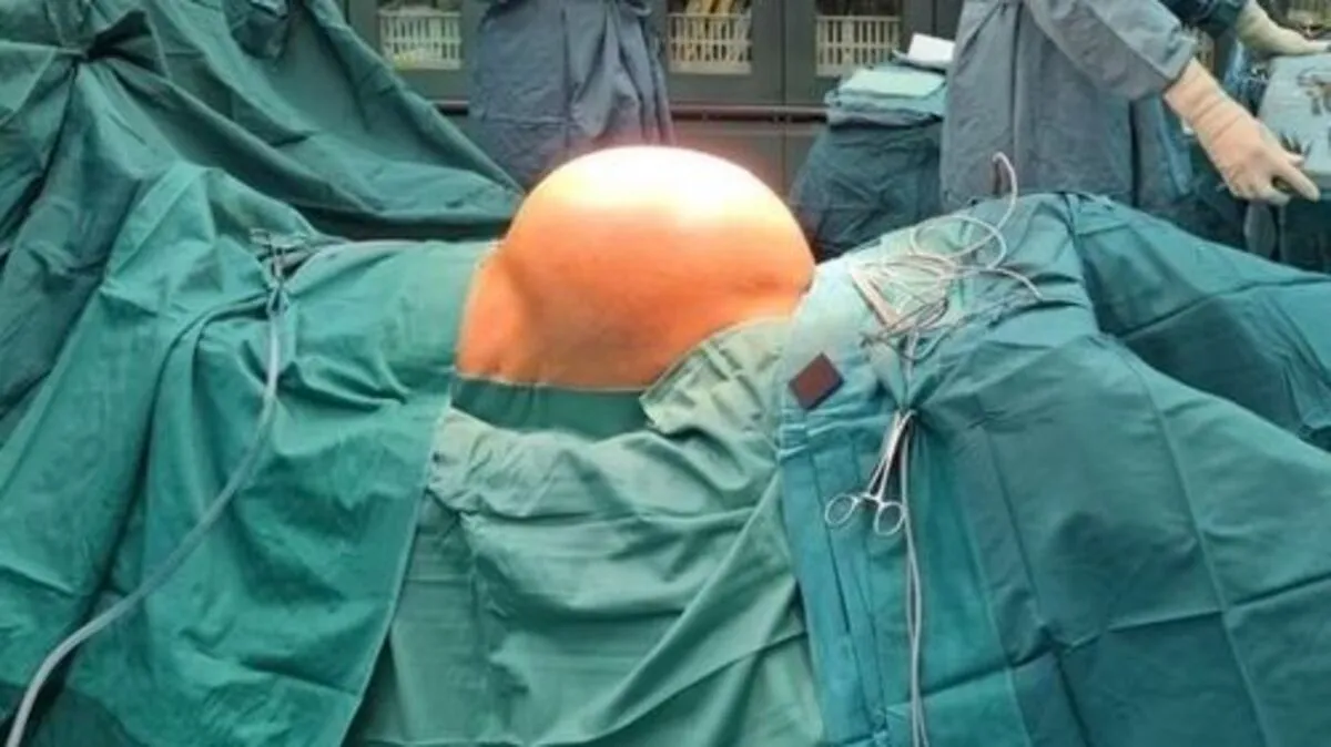 Rund zehn Kilogramm schwer war der Tumor mit einem Durchmesser von 30 Zentimetern