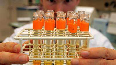 Die Doping-Labore arbeiten unter Hochdruck