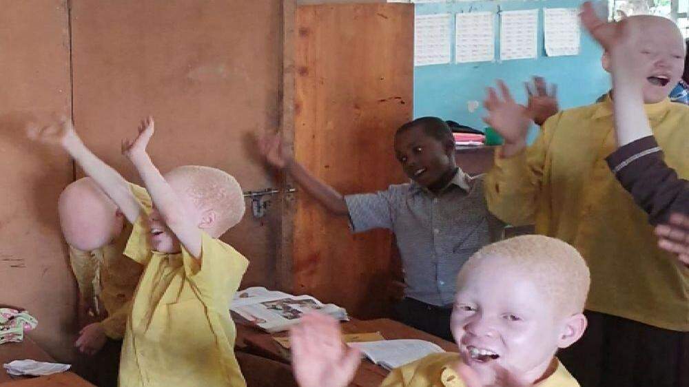 Der Bedarf nach Ausbildungsplätzen für Kinder und Jugendliche, die an Albinismus erkrankt sind, ist groß