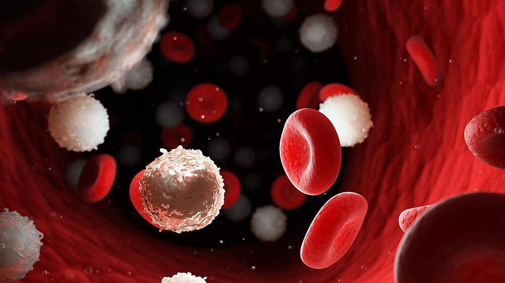 Gegen Blutkrebs wurde eine neue, verträglichere Therapieform entwickelt