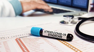 „Es ist erschreckend, wie viele ehemals Infizierte nach zwei Jahren noch Beschwerden und Einschränkungen haben“, sagte Studienleiter Winfried Kern