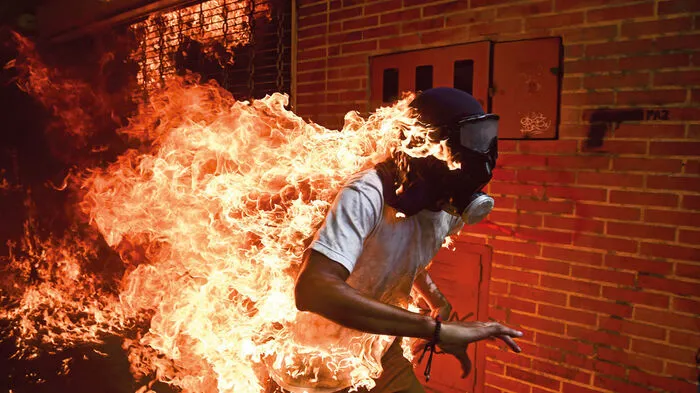 Mit diesem Bild aus Caracas gewann Ronaldo Schemodt den diesjährigen Bewerb. Der junge Mann auf dem Foto überlebte die Explosion eines Motorrads zum Glück mit Verbrennungen ersten und zweiten Grades.