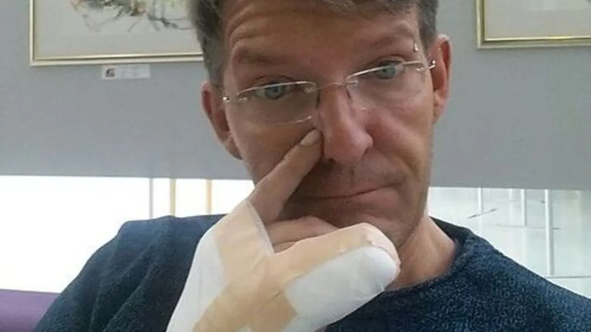 Gerald Grabner erlitt Verbrennungen an der Hand.