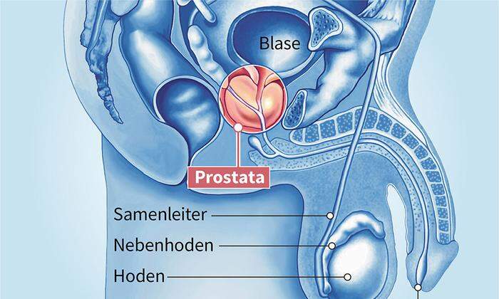 In Österreich wird pro Jahr bei mehr als 5000 Männern die Diagnose Prostatakrebs gestellt