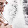 Lungenkrebs ist eine der tödlichsten Krebsarten