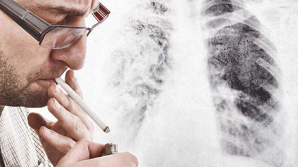 Lungenkrebs ist eine der tödlichsten Krebsarten