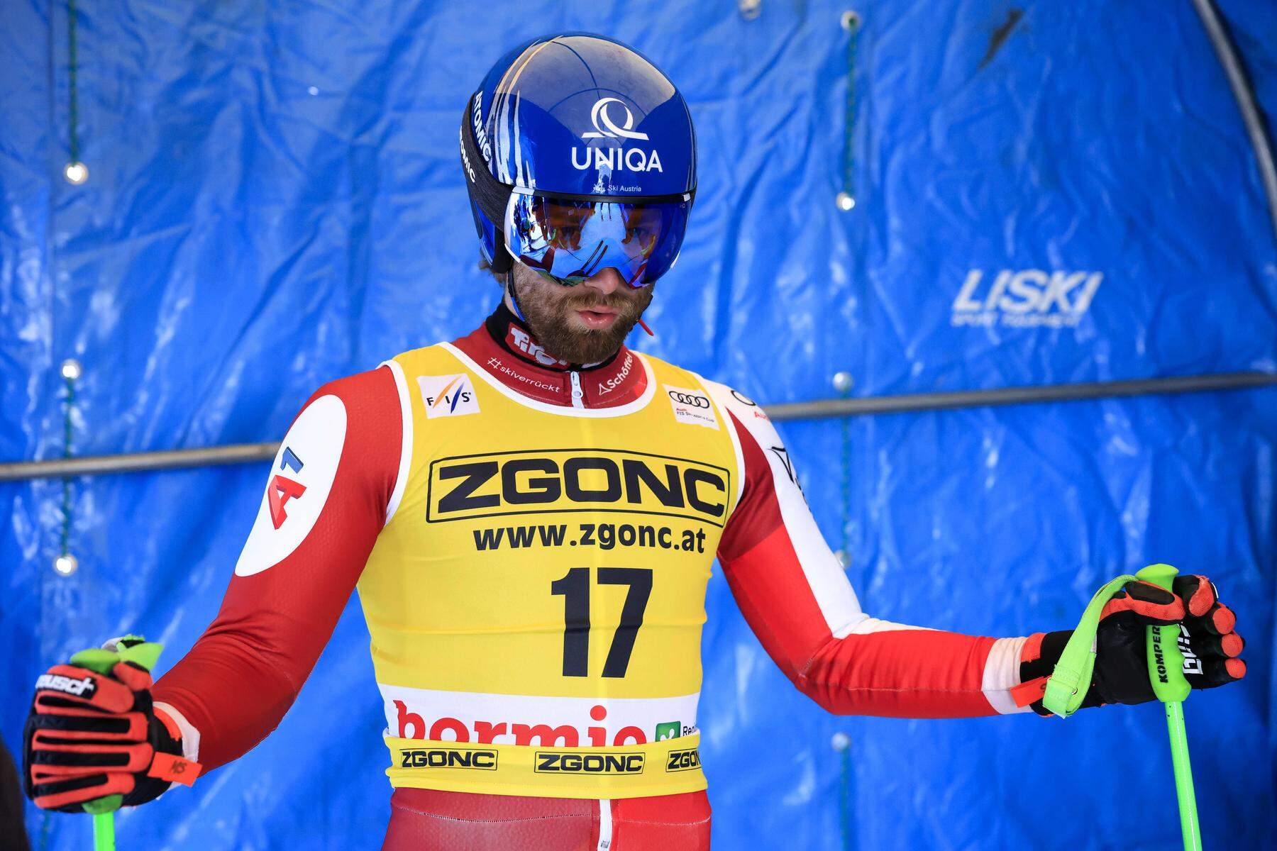Verletztes Ski-Ass | Marco Schwarz spricht erstmals nach schwerer Verletzung: „Ich will mir Zeit geben“