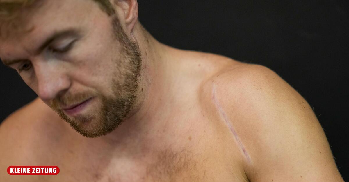 Nächste Horrorverletzung bei Alexander Aamodt Kilde