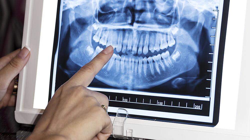 Die Zahnärztin soll mehr Zähne behandelt haben, als notwendig war (Sujetbild)