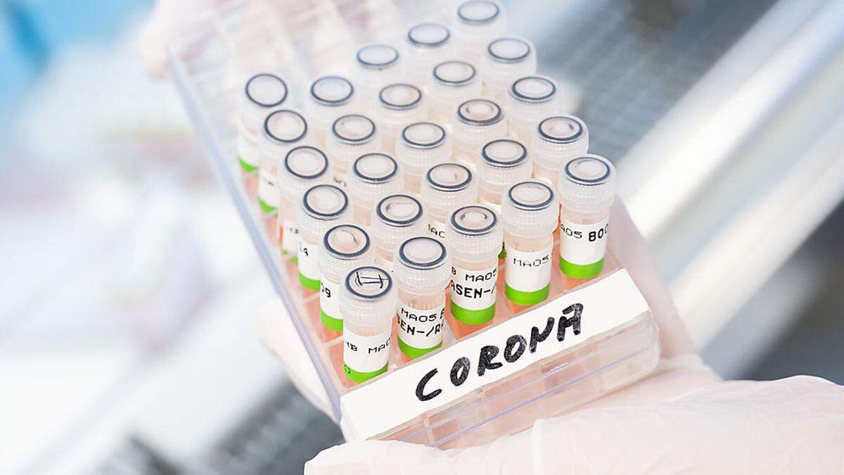 Weniger Corona-Tests bedeuten weniger bestätigte Neuinfektionen - zählen die Zahlen dann noch?