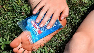 Meist helfen bei Wespenstichen Kompressen, bei einer allergischen Reaktion droht aber Gefahr