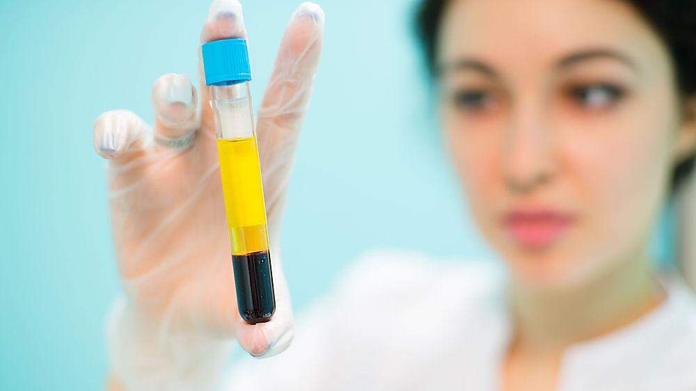 Negative Studie: Wirkt die Blutplasma-Therapie gar nicht?
