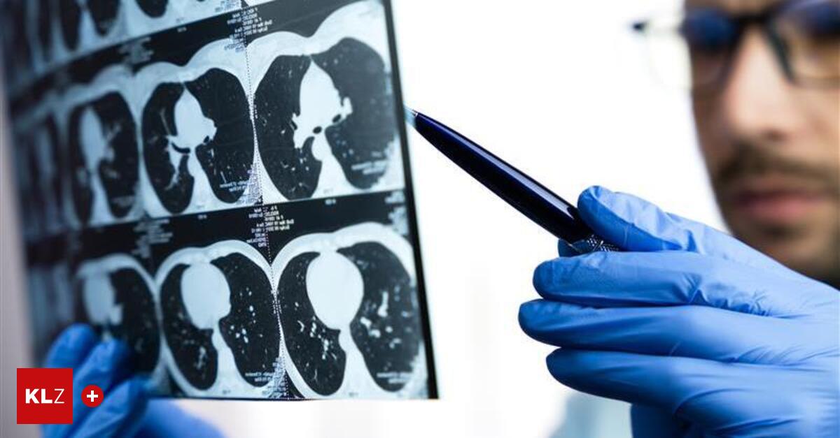 M-gliche-Fehldiagnose-Gesunder-Frau-wurde-ein-Teil-der-Lunge-entfernt