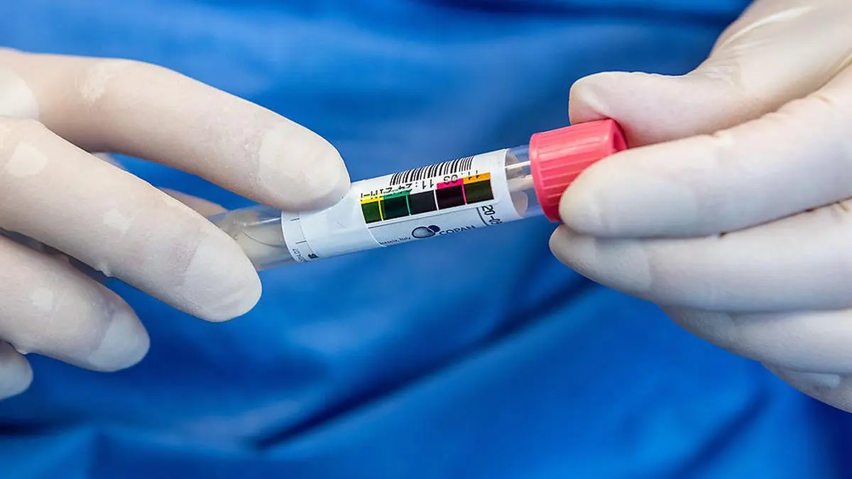 Coronavirus - Virologie am Uniklinikum Dresden