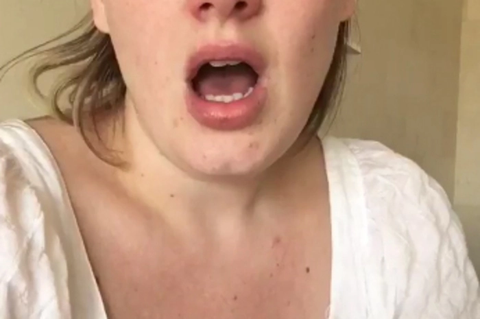 Kaum wieder zu erkennen ohne Make-up ist die britische Sängerin Adele...