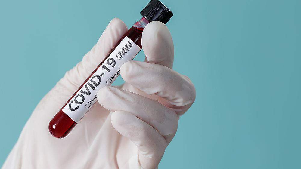 954 Kärntner sind aktuell mit Covid-19 infiziert