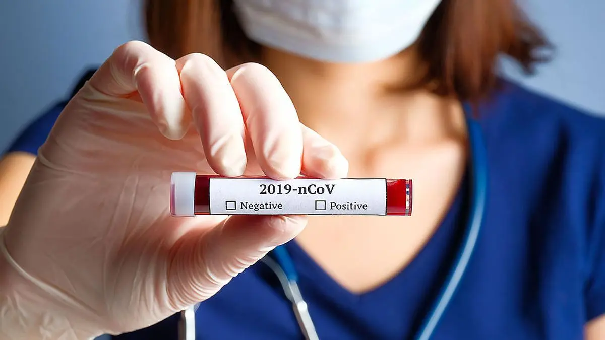 529 Neuinfizierten stehen 409 Neugenesene gegenüber