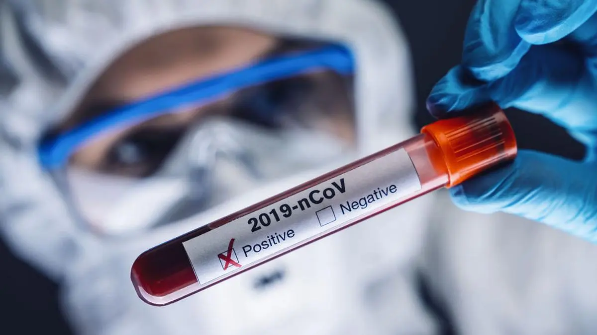 Viele neue positive Tests im Murtal 