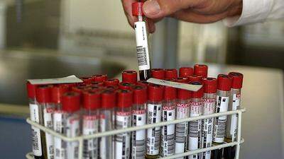 Bei der Studie werden Blutproben der Teilnehmer auf HCB untersucht	