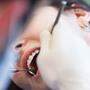 Horror beim Zahnarzt für dutzende Kärntner
