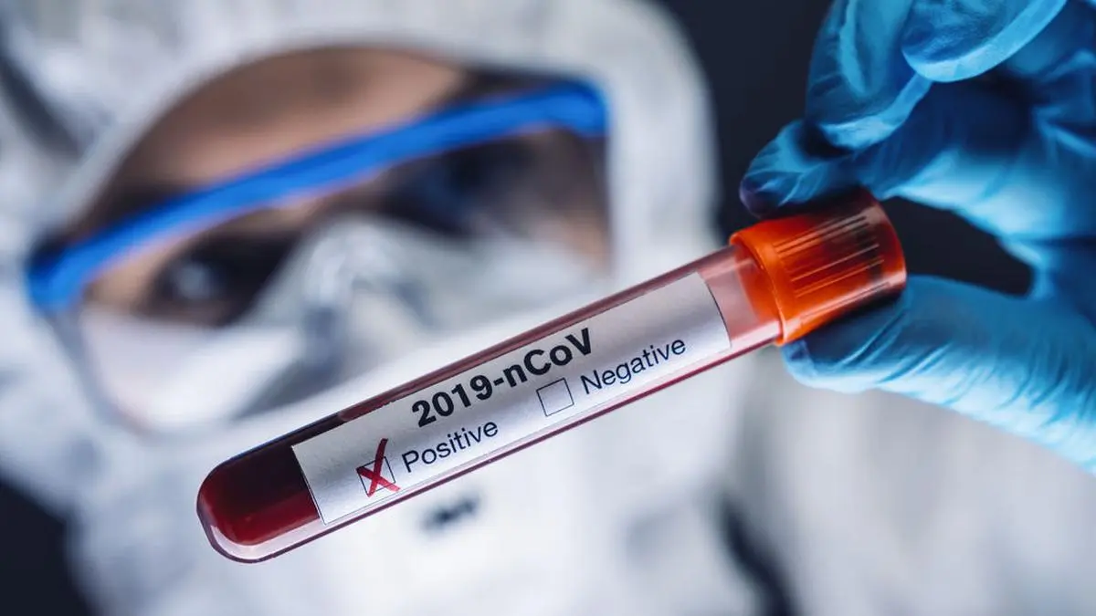 Die Infektionszahlen steigen permanent