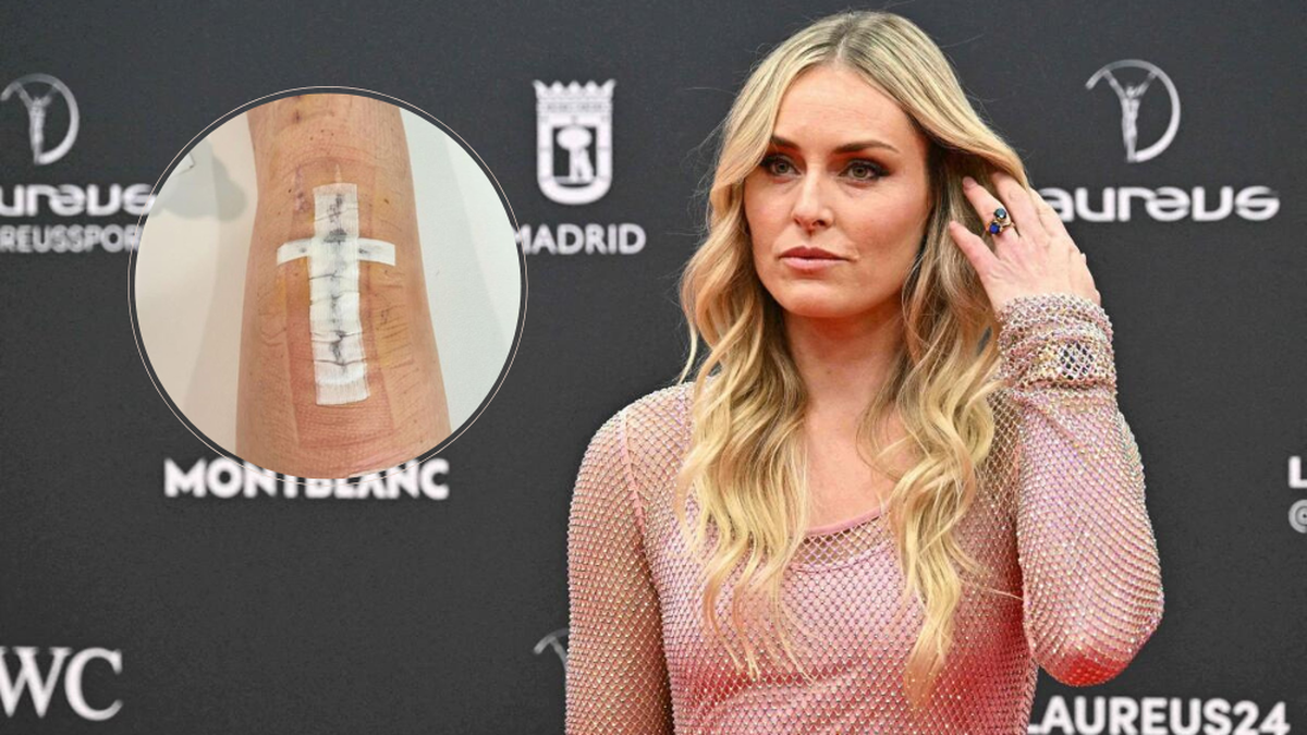 Lindsey Vonn war am Donnerstag bei den Laureus Awards in Madrid zu Gast, zwei Wochen zuvor bekam sie ein künstliches Knie-Gelenk