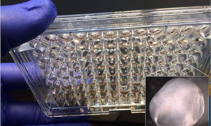 Bilder aus dem Labor: Mini-Kapillargefäße
