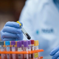 Laut russischen Medienberichten soll sich die Labormitarbeiterin an einem zerbrochenen Reagenzglas infiziert haben.