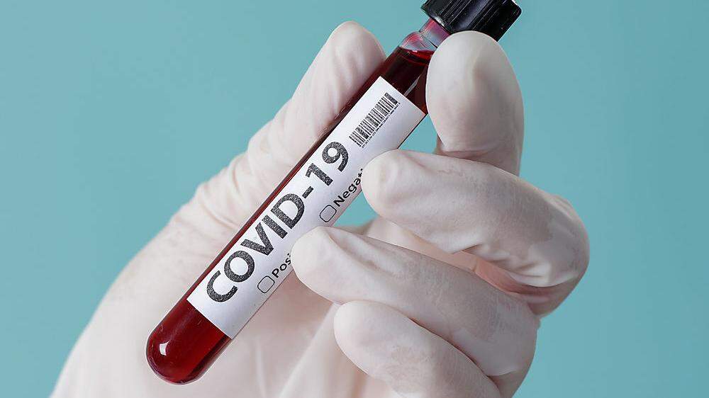 Aktuell sind 582 Kärntner mit Covid-19 infiziert
