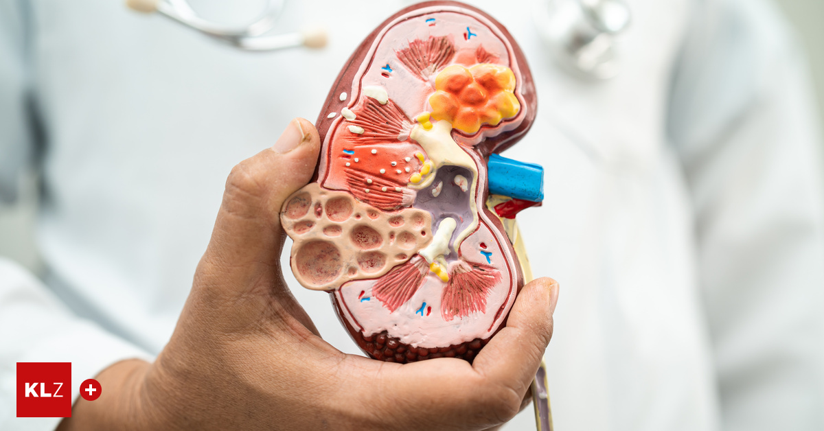 Weltnierentag: So bleibt die Niere lange gesund